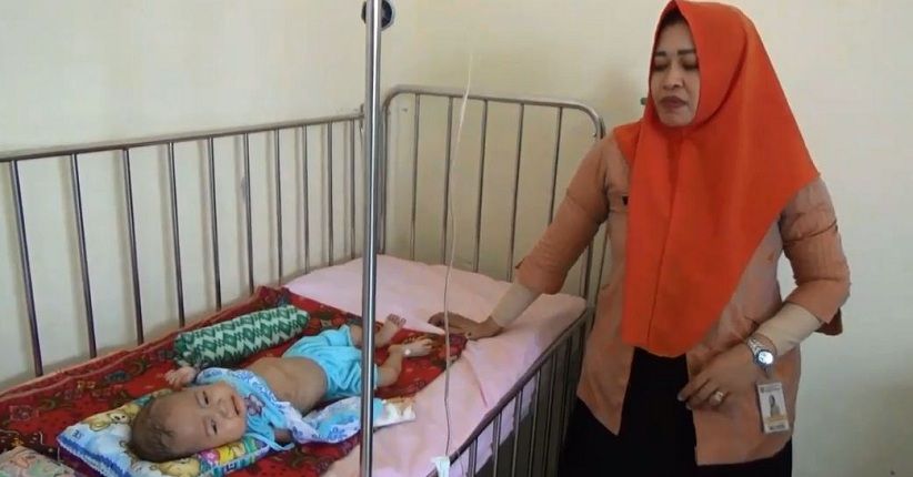 3 Penderita Gizi Buruk Dirawat di RSUD Polewali Mandar, 1 Meninggal