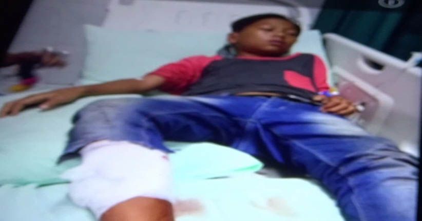 Beli Jajan di Warung, Bocah 14 Tahun di Medan Terkena Peluru Nyasar