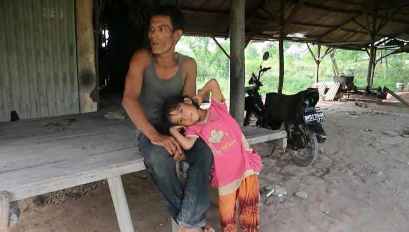 Bocah Pengidap Tumor Ganas Tunggu Uluran Tangan Pemerintah