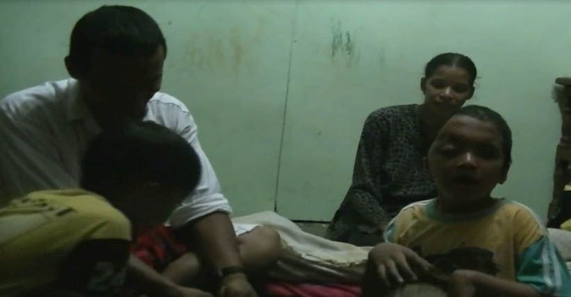 Tujuh Tahun, Bocah Medan Ini Hidup Tanpa Tempurung Kepala