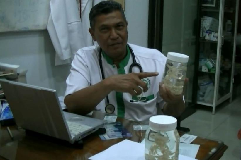 Cacing Pita Terpanjang di Dunia Ditemukan di Tubuh Warga Simalungun