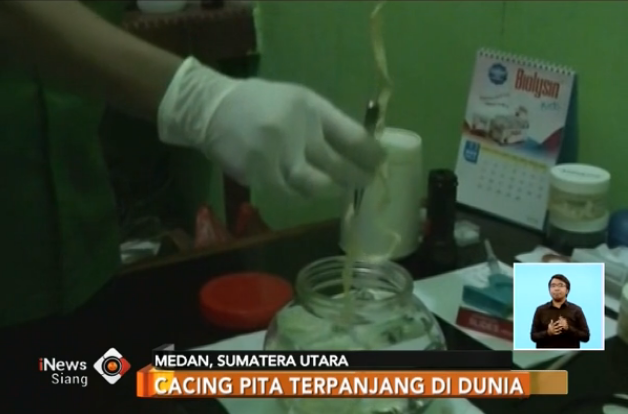 Terpanjang di Dunia, Cacing Pita 10 Meter Ditemukan di Medan