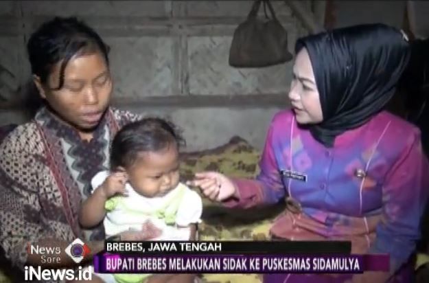 Ditolak Puskesmas, Bupati Brebes Minta Maaf ke Orangtua Bayi