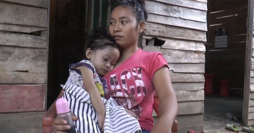 Tak Punya Biaya, Balita dengan Jantung Terbalik hanya Dirawat di Rumah