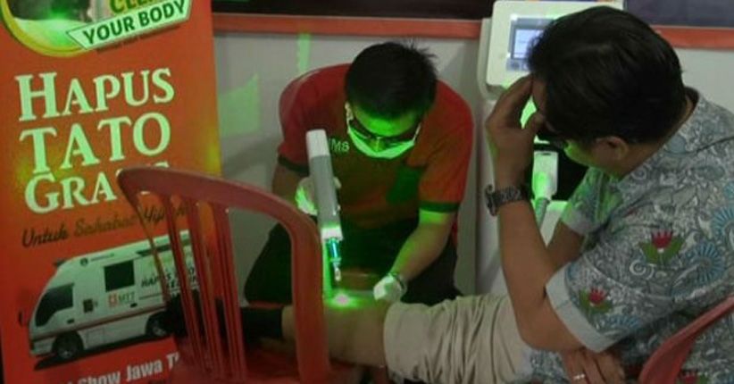 Ratusan Warga Antusias Hapus Tato Gratis di Malang