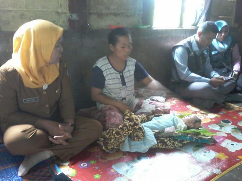 title Bayi Penderita Pembengkakan Pembuluh Darah di Tapteng Butuh Bantuan Bayi Penderita Pembengkakan Pembuluh Darah di Tapteng Butuh Bantuan