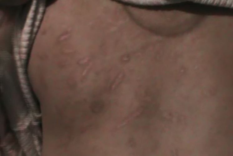 Sadis, Ibu Tega Aniaya Anak Kandung Hanya Gegara Pakaian yang Tertinggal