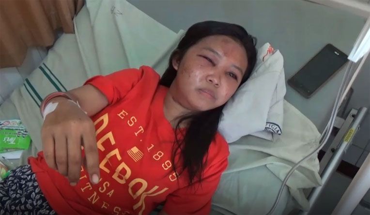 Siswi SMK Ini Nyaris Tewas Usai Dibegal Teman Sendiri di Boyolali