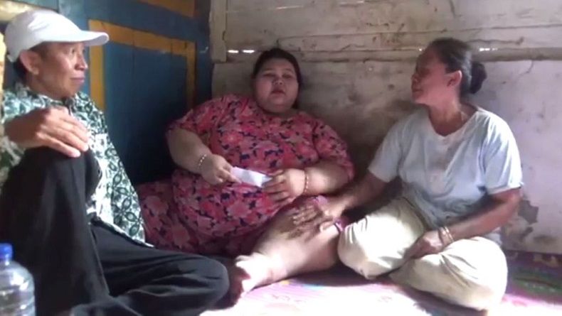 Kisah Silvia Gadis Obesitas asal Lamongan, Putus Sekolah karena Malu