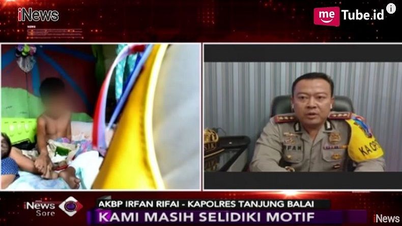 Bocah Dibakar Teman di Tanjungbalai, Polisi: Korban Suka Minum Bensin
