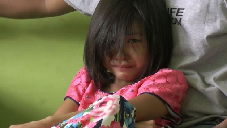 Tomcat Serang Warga di Tuban, Kulit Bocah TK Alami Luka Melepuh