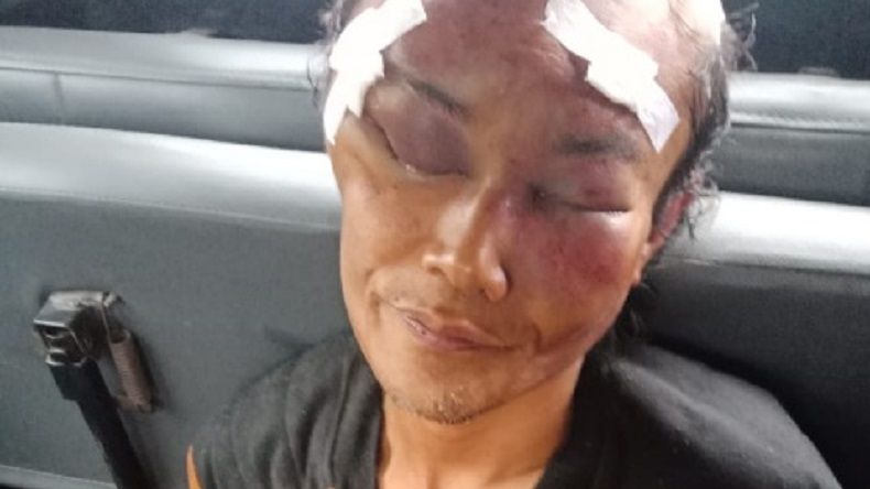Diduga Hendak Memerkosa Wanita, Orang Gila Ini Dipukuli Warga