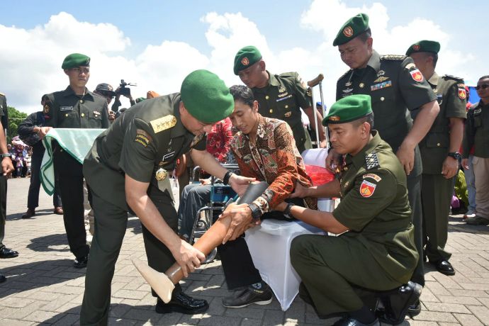 Bantuan Kaki Palsu TNI AD, Pria Ini Bisa Berjalan Normal Usai 24 Tahun