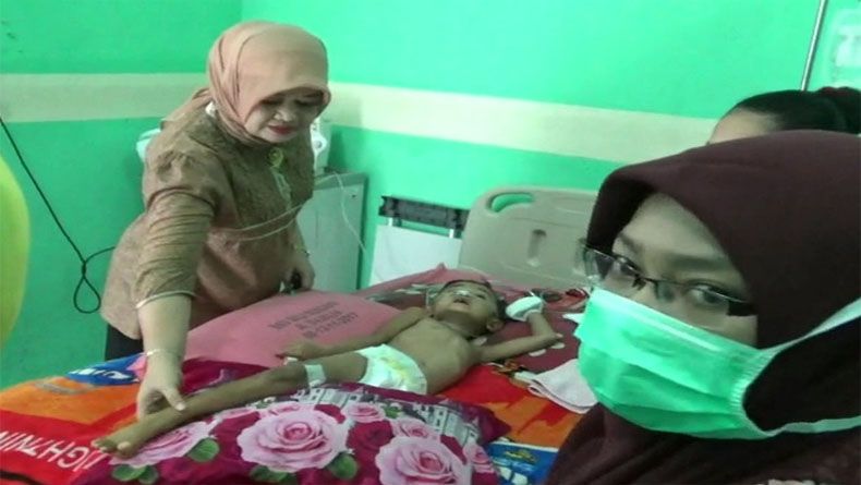 Hasil Diagnosis, Gilang Si Balita Tidur Asal Sumut Idap Infeksi Otak