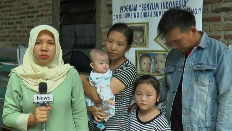 MNC Peduli-RS Pertamina Bintang Amin Kunjungi Pasien Bibir Sumbing