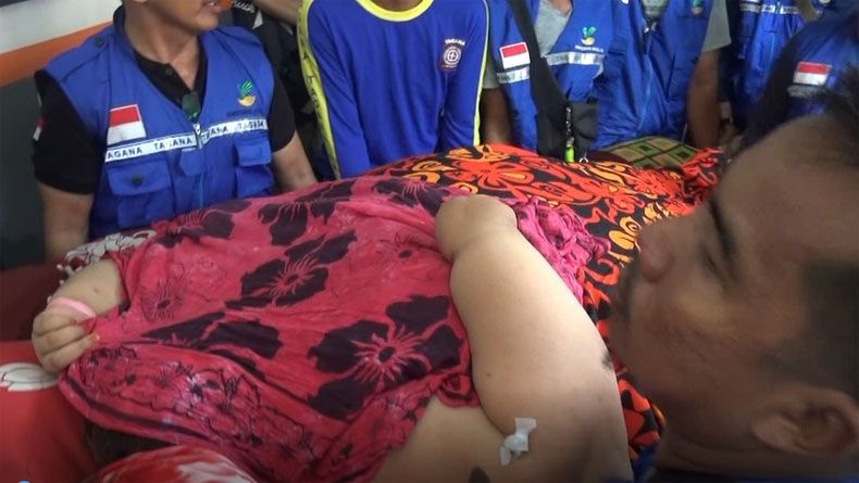Usai Jalani Operasi, Begini Kondisi Titi Wati Wanita Berbobot 220 Kg