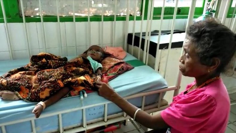 RSUD Kota Soe Rawat 8 Pasien Gizi Buruk