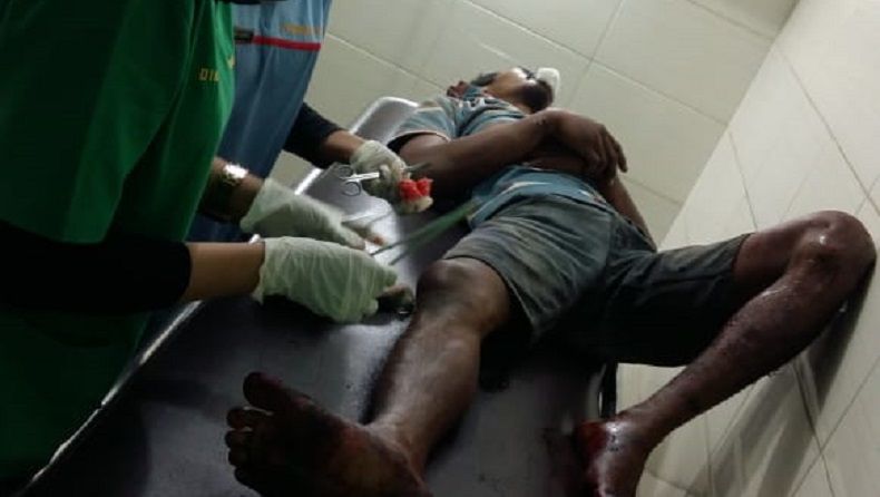 13 Kali Sukses, Spesialis Pencuri di Medan Akhirnya Apes