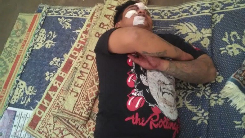 Curi Jaket dan Sandal, Pelaku Babak Belur Dipukuli Warga