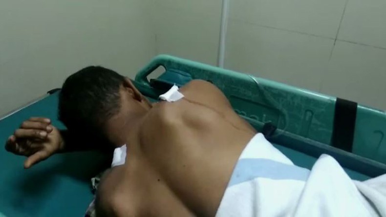 Mandor Perkebunan PT Pinago Utama Ditembak OTK di Musi Banyuasin