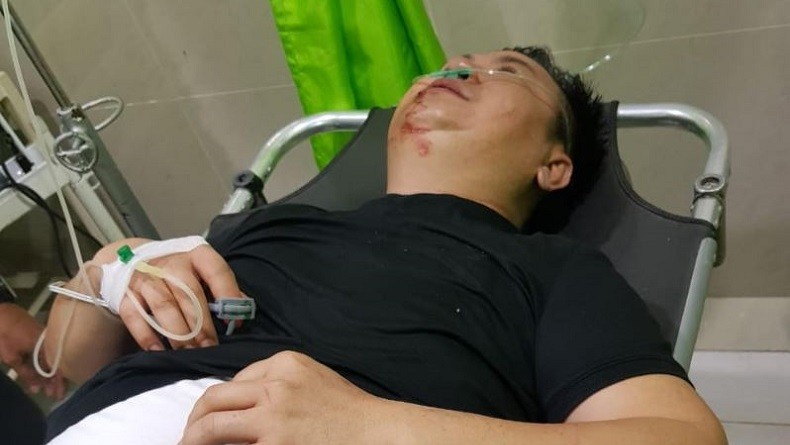 Korban Masih Kritis, Bos Money Changer di Batam Belum Jadi Tersangka