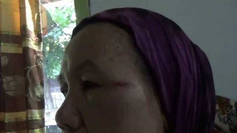 Terkena Peluru Nyasar, 1 Warga di Pasuruan Terluka dan Kaca Rumah Pecah