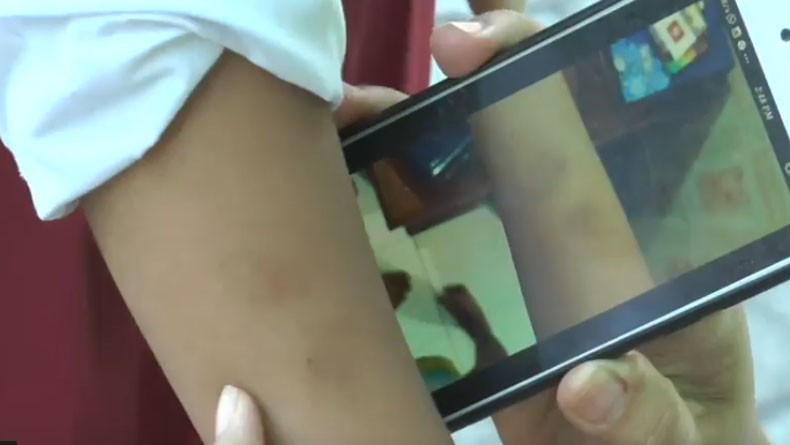 Salah Jawab Soal, Siswa SD di Surabaya Dicubit Guru hingga Takut Masuk Sekolah