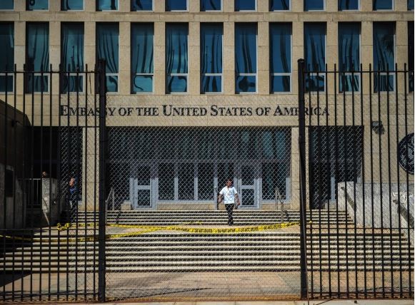 Hasil Scan Tunjukkan Para Diplomat AS di Kuba Alami Kelainan Otak