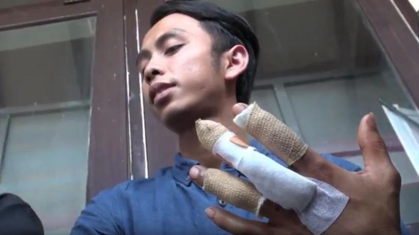 Heboh Bos Kafe Hantam Jari Karyawan Pakai Palu 5 Kali hingga Remuk di Malang