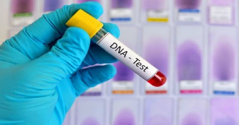 Tim Inafis Polda Jatim dan Densus 88 Ambil Sampel DNA Ibu Terduga Teroris di Madiun