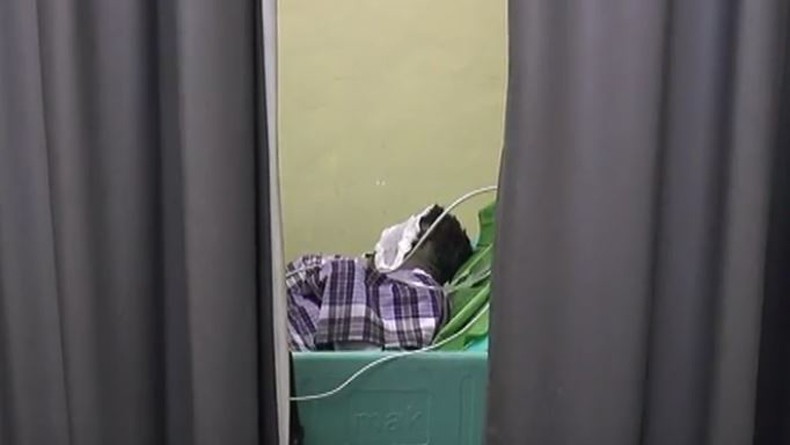 Istri Bakar Suami saat Tidur hingga Kritis di Palembang