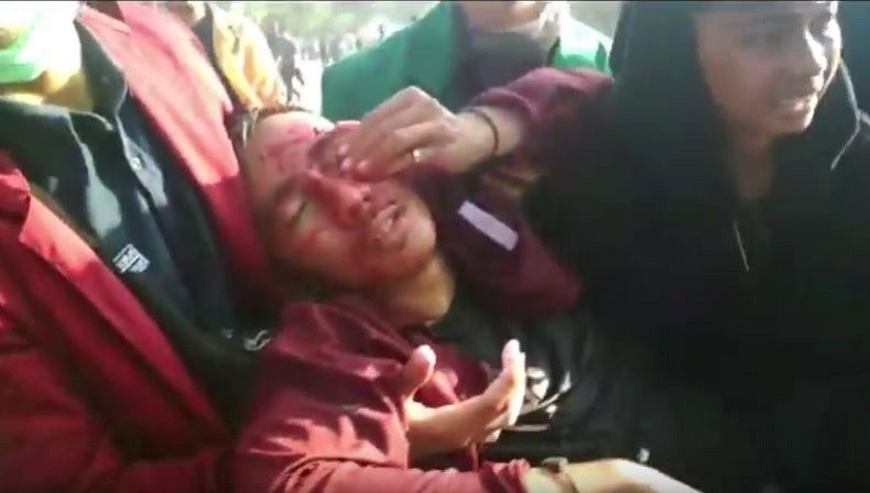 Aksi Demo Mahasiswa di Samarinda Berakhir Ricuh, Puluhan Mahasiswa Dilarikan ke RS