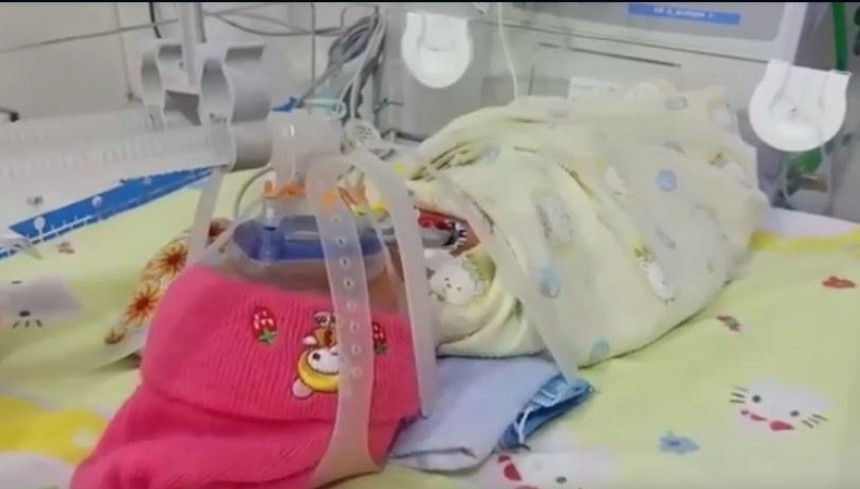 Bayi Lahir Prematur, Bibir Sumbing dan Berkelamin Ganda di Sumbawa Perlu Uluran Tangan