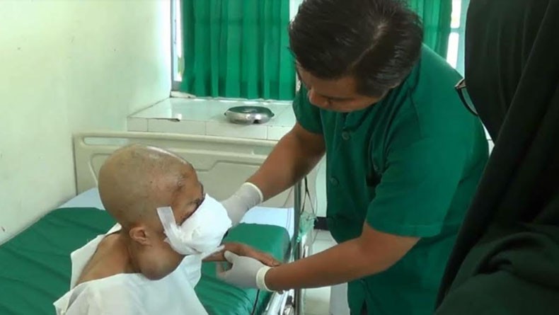 Janda 2 Anak di Kendal Idap Kanker Rongga Mulut Ganas Butuh Bantuan, 7 Bulan Tak Bisa Makan