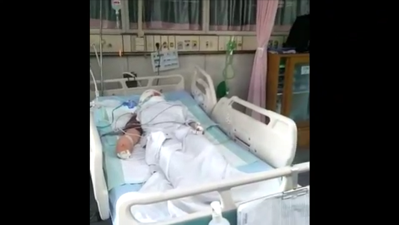 Kasus Suami Bakar Istri di Surabaya, Kondisi Korban Mulai Stabil