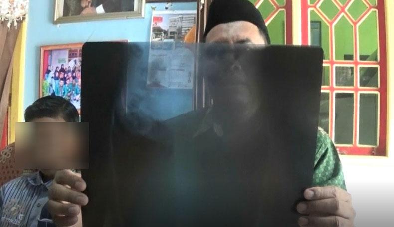 Siswa SMP di Blitar Di-bully dan Dipukul Teman Kelas hingga Pingsan 6 Kali di Sekolah