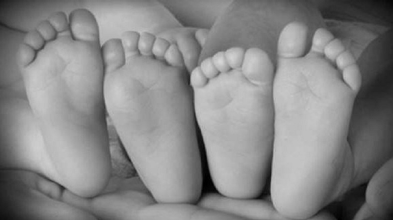 Bayi Kembar Siam Asal Labuhanbatu Direncanakan akan Operasi Pemisahan di Usia 9 Bulan