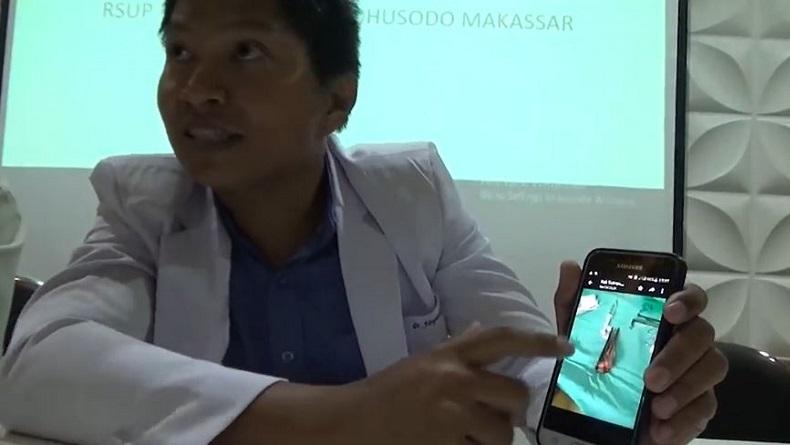 Begini Kronologi Moncong Ikan Marlin Menancap di Leher Siswa SMP di Buton Selatan