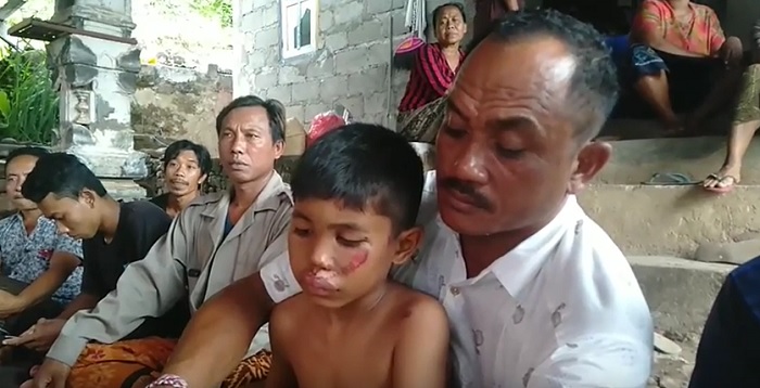 Sekeluarga di Karangasem Tertimpa Pohon, Ayah Kritis dan 1 Anaknya Tewas