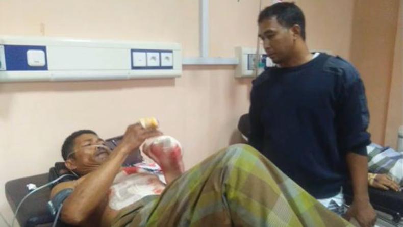 title Bom Ikan Meledak saat Dirakit, Seorang Nelayan di Polewali Mandar Luka Parah di Tangan Bom Ikan Meledak saat Dirakit, Seorang Nelayan di Polewali Mandar Luka Parah di Tangan