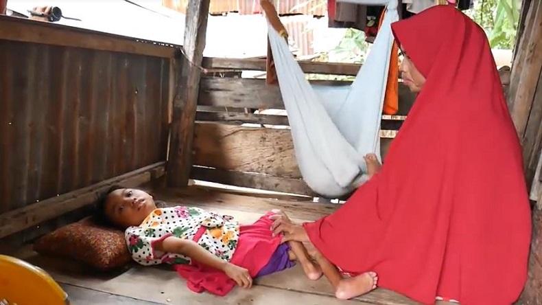 Bocah Usia 8 Tahun di Barru Menderita Lumpuh Layu sejak Usia 17 Bulan