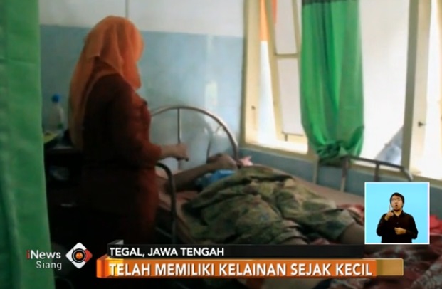 Wanita Berkelamin Ganda Lahirkan Bayi Laki-laki di Tegal
