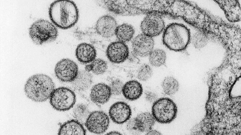 Hantavirus Hebohkan Dunia di Tengah Pandemi Virus Corona - Bagian 1