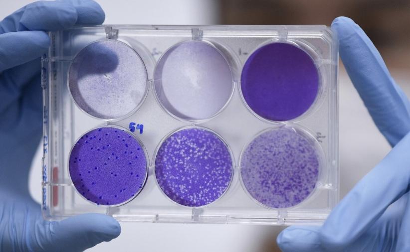 Berlawanan dengan Trump, Prancis Sebut Tak Ada Bukti Virus Corona dari Lab Wuhan