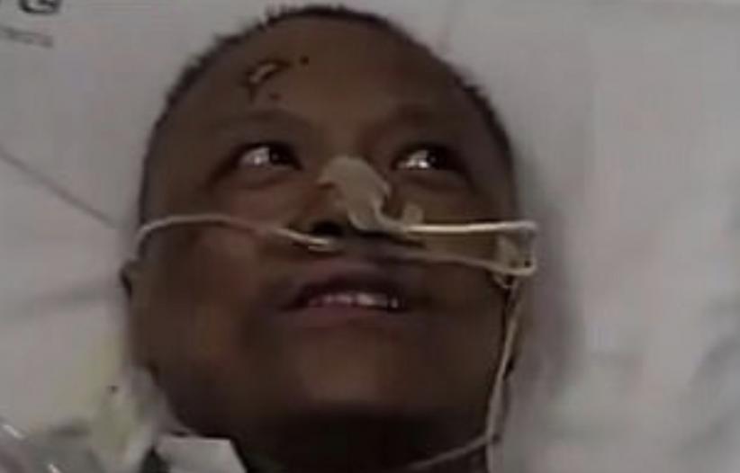 Ternyata Virus Corona Bisa Membuat Kulit Penderita Jadi Hitam   