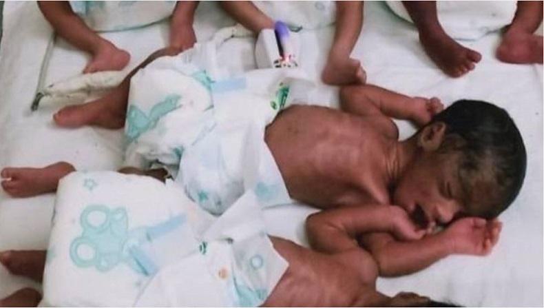 Wow, Ibu di India Melahirkan 5 Bayi Kembar Sehat saat Wabah Corona