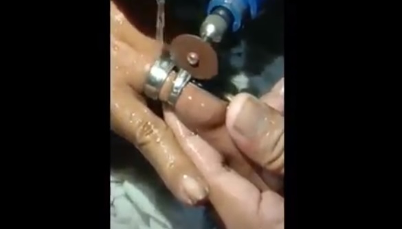title Dramatis, Petugas Damkar Jambi Potong Cincin dari Jari Ibu Muda Dramatis, Petugas Damkar Jambi Potong Cincin dari Jari Ibu Muda
