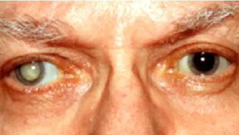 BPJS Kesehatan Kota Ambon Sosialisasikan 2 Peraturan Baru Tentang Kesehatan Mata