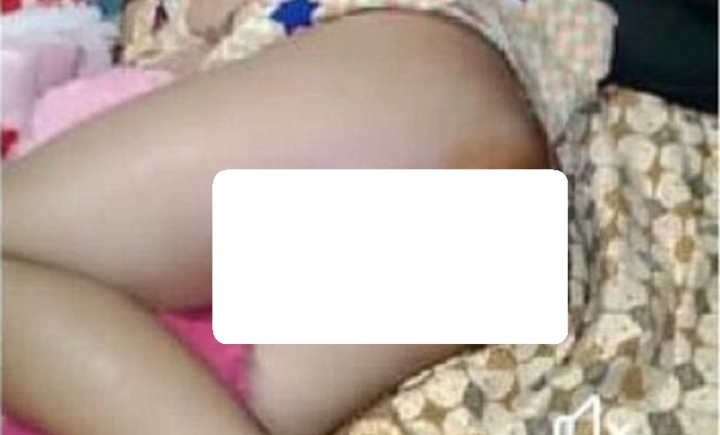 Miris, Bocah Penderita Kanker di Kayong Utara Hanya Dirawat di Rumah