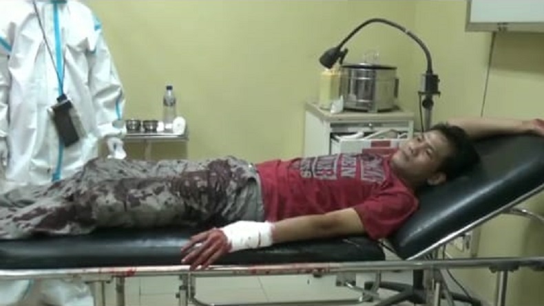 Penjaga Malam di Palembang Tiba-Tiba Dibacok saat Beli Nasi, Tangan Kiri Nyaris Putus